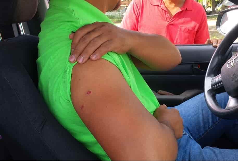 Ganadero resulta herido en atentado armado en Arenal, Yoro